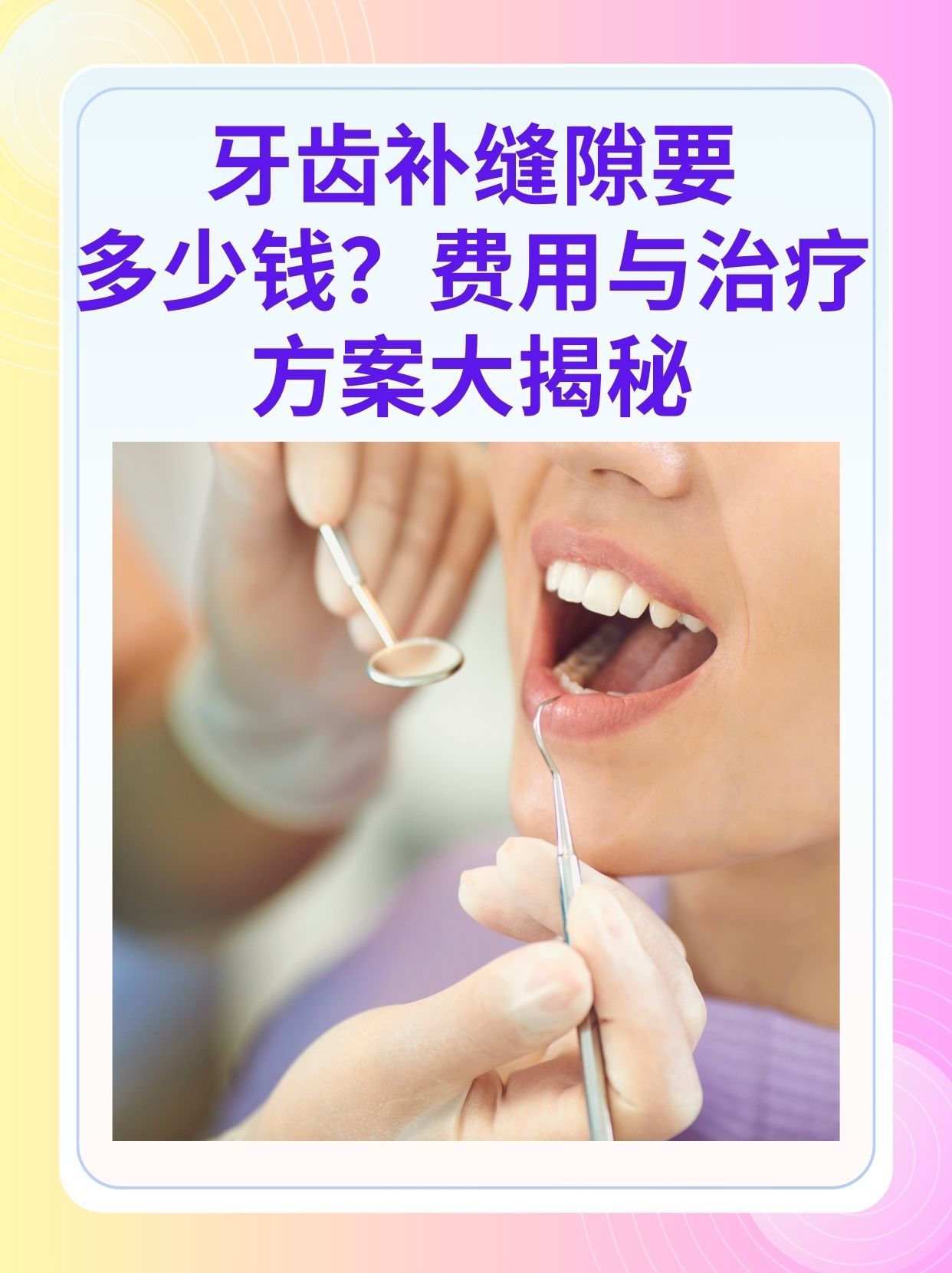 张家口补牙医保可以报销吗(补牙医保可以报销吗 哪些可以报销呢)